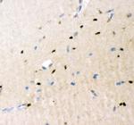 CRK Antibody in Immunohistochemistry (Paraffin) (IHC (P))