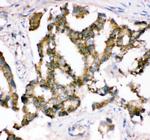 CRK Polyclonal Antibody