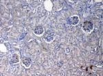 CRP Polyclonal Antibody