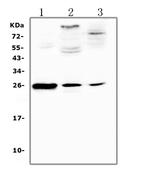 CRP Antibody in Western Blot (WB)