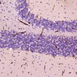 CRP Polyclonal Antibody
