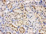 CRY2 Polyclonal Antibody