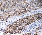 Cystatin B Polyclonal Antibody