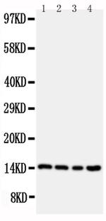 Cystatin B Antibody in Western Blot (WB)