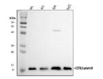 Cystatin B Antibody in Western Blot (WB)