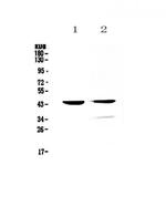Cathepsin D Antibody in Western Blot (WB)