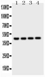 Cathepsin D Antibody in Western Blot (WB)