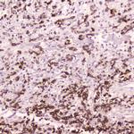 Cathepsin E Polyclonal Antibody