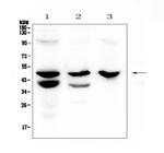 Cathepsin E Antibody in Western Blot (WB)