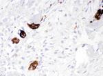 Cathepsin K Polyclonal Antibody