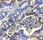 IL-8 (CXCL8) Polyclonal Antibody