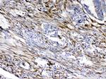 Cytoglobin Polyclonal Antibody