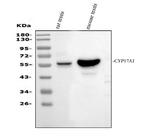 CYP17A1 Antibody in Western Blot (WB)