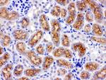 CYP24A1 Antibody in Immunohistochemistry (Paraffin) (IHC (P))