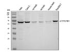 CYP27B1 Antibody in Western Blot (WB)