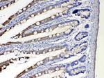 CYP2D6 Antibody in Immunohistochemistry (Paraffin) (IHC (P))