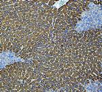 CYP2E1 Polyclonal Antibody