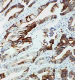 CYP2U1 Antibody in Immunohistochemistry (Paraffin) (IHC (P))