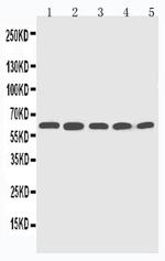 CYP2U1 Antibody in Western Blot (WB)