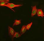 DAXX Polyclonal Antibody