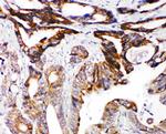 DCC Polyclonal Antibody