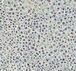 DCK Antibody in Immunohistochemistry (Paraffin) (IHC (P))