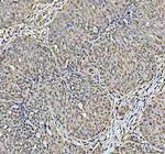 DCK Antibody in Immunohistochemistry (Paraffin) (IHC (P))