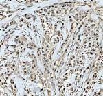 DCK Polyclonal Antibody