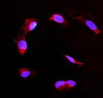 DDAH2 Polyclonal Antibody