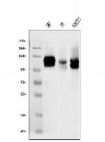 DDR2 Polyclonal Antibody