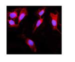 RIG-I Polyclonal Antibody
