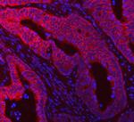 RIG-I Antibody in Immunohistochemistry (Paraffin) (IHC (P))