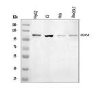 RIG-I Antibody in Western Blot (WB)