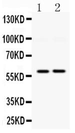 DGAT1 Polyclonal Antibody