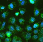 DGCR8 Polyclonal Antibody