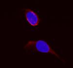 DHFR Polyclonal Antibody