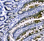 DHFR Antibody in Immunohistochemistry (Paraffin) (IHC (P))