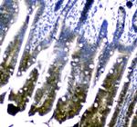 DHFR Antibody in Immunohistochemistry (Paraffin) (IHC (P))