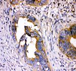 DHFR Antibody in Immunohistochemistry (Paraffin) (IHC (P))