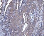Dicer Polyclonal Antibody