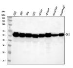 DLD Antibody in Western Blot (WB)