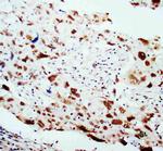 HSP40 Antibody in Immunohistochemistry (Paraffin) (IHC (P))