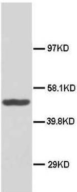 HSP40 Antibody in Western Blot (WB)