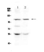 DPYD Polyclonal Antibody