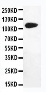 DPYD Polyclonal Antibody