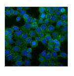 Desmoglein 2 (DSG2) Polyclonal Antibody
