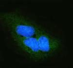 DYNLT1 Polyclonal Antibody