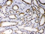 EBAG9 Polyclonal Antibody