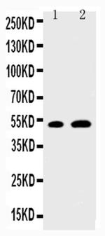 EGR2 Polyclonal Antibody