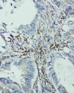 eIF6 Polyclonal Antibody